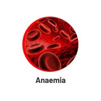 Anaemia Anaemia